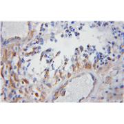 COX5B Rabbit Polyclonal Antibody (11418-2-AP)