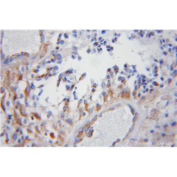 COX5B Rabbit Polyclonal Antibody (11418-2-AP)