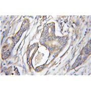 AGTRAP Rabbit Polyclonal Antibody (11559-1-AP)