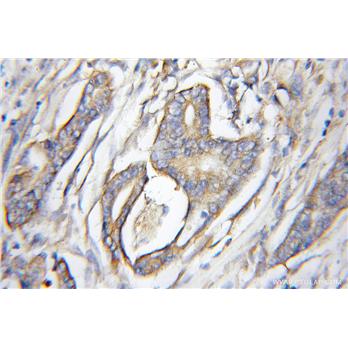 AGTRAP Rabbit Polyclonal Antibody (11559-1-AP)