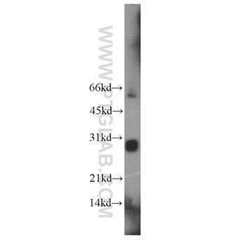 LIN28 Rabbit Polyclonal Antibody (11724-1-AP)