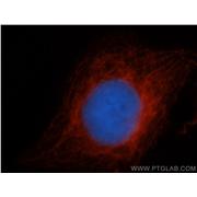CDC6 Rabbit Polyclonal Antibody (11640-1-AP)