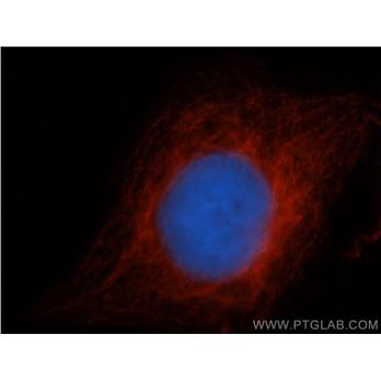 CDC6 Rabbit Polyclonal Antibody (11640-1-AP)