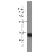 SULT1A4 Rabbit Polyclonal Antibody (11376-1-AP)