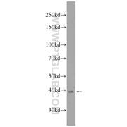 UCHL5 Rabbit Polyclonal Antibody (11527-1-AP)