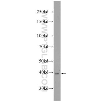 UCHL5 Rabbit Polyclonal Antibody (11527-1-AP)