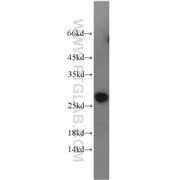 PCTP Rabbit Polyclonal Antibody (11167-1-AP)