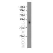 PSMC4 Rabbit Polyclonal Antibody (11389-1-AP)