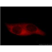 CCT5 Rabbit Polyclonal Antibody (11603-1-AP)