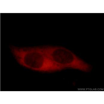 CCT5 Rabbit Polyclonal Antibody (11603-1-AP)