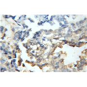 CDR2 Rabbit Polyclonal Antibody (11611-2-AP)