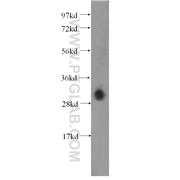 DNASE1L3 Rabbit Polyclonal Antibody (11330-1-AP)
