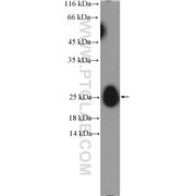 IGL- Rabbit Polyclonal Antibody (11541-1-AP)