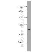 STX16 Rabbit Polyclonal Antibody (11201-1-AP)