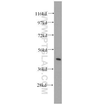 STX16 Rabbit Polyclonal Antibody (11201-1-AP)
