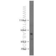 SCMH1 Rabbit Polyclonal Antibody (11489-1-AP)