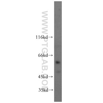 SCMH1 Rabbit Polyclonal Antibody (11489-1-AP)