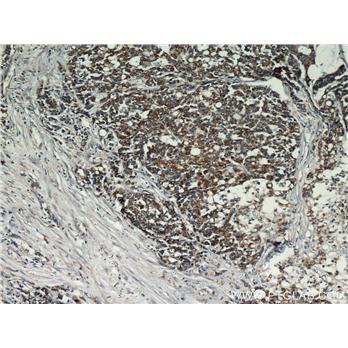 NELL2 Rabbit Polyclonal Antibody (11268-1-AP)