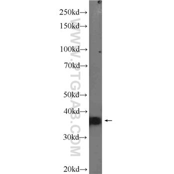 SIX2 Rabbit Polyclonal Antibody (11562-1-AP)