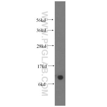 COX6B1 Rabbit Polyclonal Antibody (11425-1-AP)