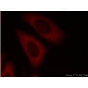 EIF3E Rabbit Polyclonal Antibody (11352-1-AP)