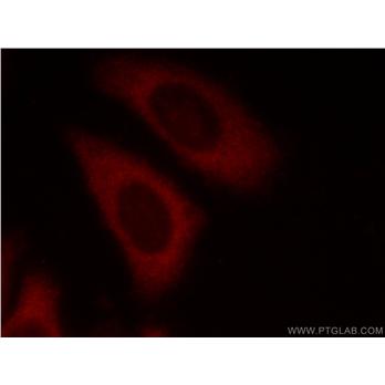 EIF3E Rabbit Polyclonal Antibody (11352-1-AP)
