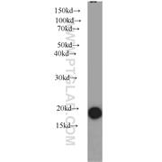STMN1 Rabbit Polyclonal Antibody (11157-1-AP)