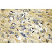 SEPT5 Rabbit Polyclonal Antibody (11631-1-AP)