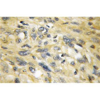 SEPT5 Rabbit Polyclonal Antibody (11631-1-AP)