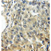 SERPINB5 Rabbit Polyclonal Antibody (11722-1-AP)