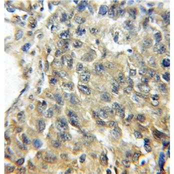 SERPINB5 Rabbit Polyclonal Antibody (11722-1-AP)