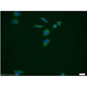 PUS1 Rabbit Polyclonal Antibody (11512-1-AP)