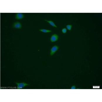 PUS1 Rabbit Polyclonal Antibody (11512-1-AP)