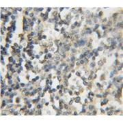 FNTB Rabbit Polyclonal Antibody (11507-1-AP)