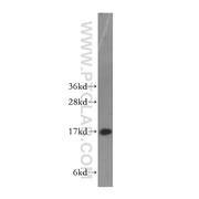 HMGN1 Rabbit Polyclonal Antibody (11695-1-AP)
