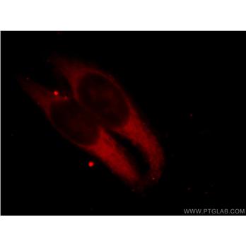 ILVBL Rabbit Polyclonal Antibody (11220-1-AP)