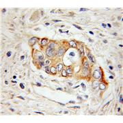 HEPH Rabbit Polyclonal Antibody (11148-1-AP)