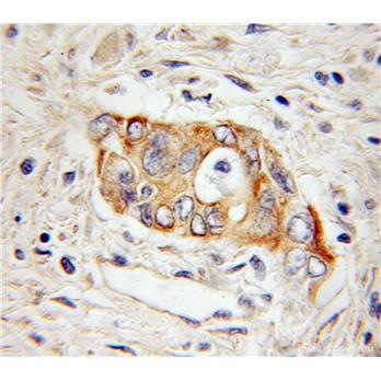 HEPH Rabbit Polyclonal Antibody (11148-1-AP)