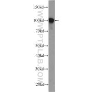 ACTN1 Rabbit Polyclonal Antibody (11313-2-AP)