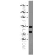 PARK7 Rabbit Polyclonal Antibody (11681-1-AP)