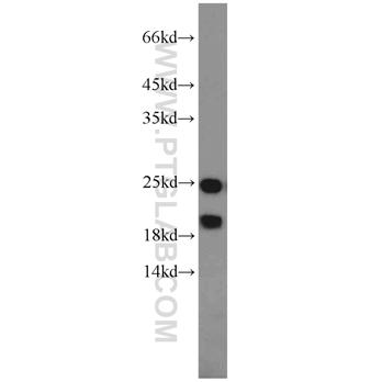 PARK7 Rabbit Polyclonal Antibody (11681-1-AP)