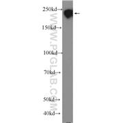 MAP4 Rabbit Polyclonal Antibody (11229-1-AP)