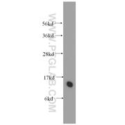 ZNF24 Rabbit Polyclonal Antibody (11219-1-AP)