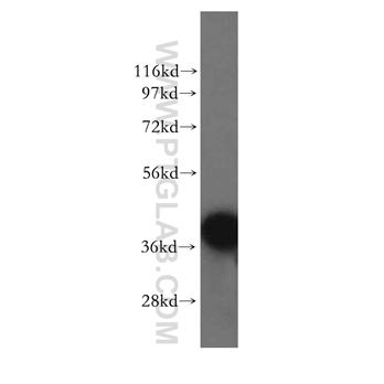 RAD51AP1 Rabbit Polyclonal Antibody (11255-1-AP)