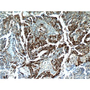 COX7A2L Rabbit Polyclonal Antibody (11416-1-AP)