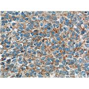 GKAP1 Rabbit Polyclonal Antibody (11395-1-AP)