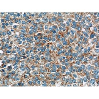 GKAP1 Rabbit Polyclonal Antibody (11395-1-AP)