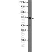 MAPK7 Rabbit Polyclonal Antibody (11164-1-AP)