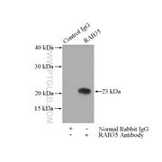 RAB35 Rabbit Polyclonal Antibody (11329-2-AP)