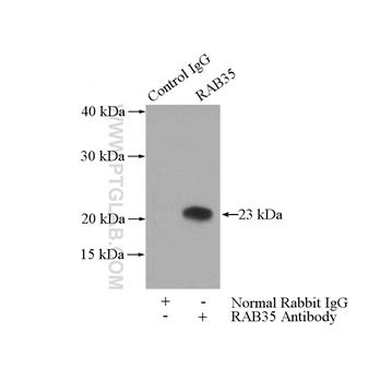 RAB35 Rabbit Polyclonal Antibody (11329-2-AP)